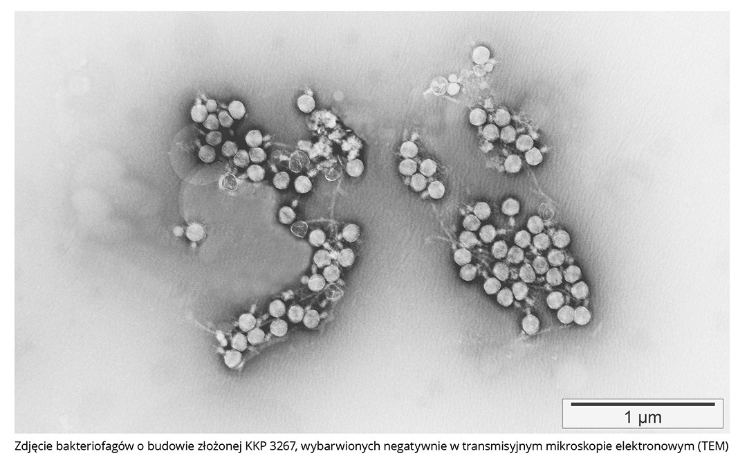 Zdjęcie bakteriofagów KKP 3267, wybarwionych negatywnie w transmisyjnym mikroskopie elektronowym